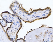 IHC staining of FFPE human placental tissue with Placental Alkaline Phosphatase antibody. HIER: boil tissue sections in pH8 EDTA for 20 min and allow to cool before testing.