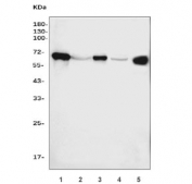 Western blot testing of human 1) placenta, 2) HepG2, 3) A431, 4) HeLa and 5) SW620 cell lysate with Placental Alkaline Phosphatase antibody. Predicted molecular weight ~58 kDa but routinely visualized at 60-70 kDa.