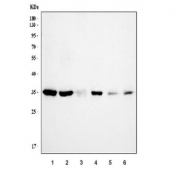 Western blot testing of 1) human HepG2, 2) human A549, 3) human ThP-1, 4) human HaCaT, 5) rat stomach and 6) mouse lung lysate with ANXA4 antibody. Predicted molecular weight ~36 kDa.