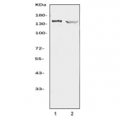 Western blot testing of human 1) HEL and 2) human HL-60 cell lysate with Apoptotic protease-activating factor 1 antibody. Predicted molecular weight ~140 kDa.