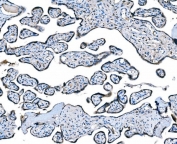 IHC staining of FFPE human placental tissue with C-C chemokine receptor type 2 antibody. HIER: boil tissue sections in pH8 EDTA for 20 min and allow to cool before testing.