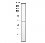 Western blot testing of human Jurkat cell lysate with C-C chemokine receptor type 2 antibody. Predicted molecular weight ~42 kDa.