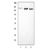 Western blot testing of 1) human HepG2, 2) rat liver and 3) mouse kidney lysate with ATP7B antibody. Expected molecular weight: 140-157 kDa.