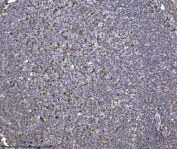 IHC staining of FFPE human tonsil tissue with SCA2 antibody. HIER: boil tissue sections in pH8 EDTA for 20 min and allow to cool before testing.