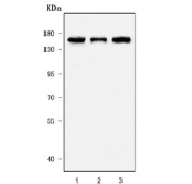 Western blot testing of human 1) K562, 2) A549 and 3) 293T cell lysate with SCA2 antibody. Expected molecular weight: 114~140 kDa.