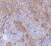IHC staining of FFPE rat kidney tissue with Batf2 antibody. HIER: boil tissue sections in pH8 EDTA for 20 min and allow to cool before testing.
