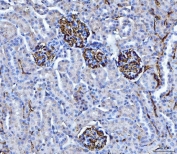 IHC staining of FFPE mouse kidney tissue with Emmprin antibody. HIER: boil tissue sections in pH8 EDTA for 20 min and allow to cool before testing.
