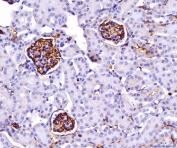 IHC staining of FFPE mouse kidney tissue with Basigin antibody. HIER: boil tissue sections in pH8 EDTA for 20 min and allow to cool before testing.