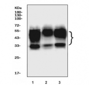 Western blot testing of human 1) HeLa, 2) Jurkat and 3) HepG2 cell lysate with Basigin antibody. Expected molecular weight: 27-66 kDa depending on level of glycosylation.