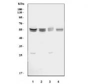 Western blot testing of human 1) HepG2, 2) Jurkat, 3) Raji and 4) K562 cell lysate with Caspase-8 antibody. Predicted molecular weight ~55 kDa (Pro form).
