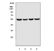 Western blot testing of human 1) K562, 2) HepG2, 3) PC-3 and 4) RT4 cell lysate with EIF5 antibody. Predicted molecular weight ~49 kDa.