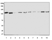 Western blot testing of 1) human HL60, 2) human K562, 3) human A549, 4) human Raji, 5) human CCRF-CEM, 6) human Daudi, 7) human MCF7, 8) human HeLa, 9) rat testis and 10) mouse ANA-1 cell lysate with CBL antibody. Expected molecular weight: 100-120 kDa.