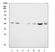 Western blot testing of 1) human HeLa, 2) human Raji, 3) human COLO-320, 4) human MCF7, 5) rat brain, 6) rat thymus and 7) mouse brain lysate with PLAUR antibody.  Expected molecular weight: 37-60 kDa, depending on glycosylation level.