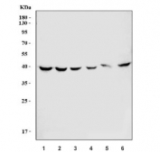 Western blot testing of 1) human HeLa, 2) human HepG2, 3) rat liver, 4) rat kidney, 5) mouse liver and 6) mouse kidney tissue lysate with Sorbitol Dehydrogenase antibody. Expected molecular weight: 38-42 kDa.