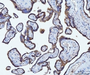 IHC staining of FFPE human placental tissue with CD55 antibody. HIER: boil tissue sections in pH8 EDTA for 20 min and allow to cool before testing.