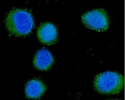 Immunofluorescent staining of FFPE human SiHa cells with CD55 antibody (green) and DAPI nuclear stain (blue). HIER: steam section in pH6 citrate buffer for 20 min.