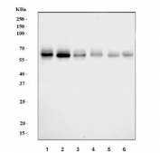 Western blot testing of 1) human HepG2, 2) human Caco-2, 3) human A549, 4) human HaCaT, 5) rat liver and 6) mouse liver lysate with Lipolysis-stimulated lipoprotein receptor antibody. Predicted molecular weight: 54-71 kDa (multiple isoforms).