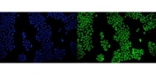 Immunofluorescent staining of FFPE human A431 cells with PPARG antibody (green) and DAPI nuclear stain (blue). HIER: steam section in pH6 citrate buffer for 20 min.