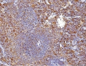 IHC staining of FFPE mouse spleen tissue with Cd70 antibody. HIER: boil tissue sections in pH8 EDTA for 20 min and allow to cool before testing.
