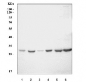 Western blot testing of 1) rat spleen, 2) rat thymus, 3) rat lung, 4) rat L6, 5) rat PC-12 and 6) mouse B16 cell lysate with Cd70 antibody. Predicted molecular weight ~21 kDa but may be observed at up to ~80 kDa due to glycosylation.