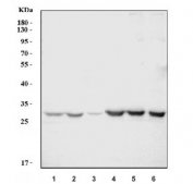 Western blot testing of mouse 1) spleen, 2) thymus, 3) lung, 4) RAW264.7, 5) Ana-1 and 6) SP2/0 cell lysate with Cd70 antibody. Predicted molecular weight ~21 kDa but may be observed at up to ~80 kDa due to glycosylation.