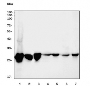 Western blot testing of 1) human Jurkat, 2) human HepG2, 3) human K562, 4) rat heart, 5) rat L6, 6) mouse heart and 7) mouse C2C12 cell lysate with CDK2 antibody. Predicted molecular weight: 30-33 kDa.