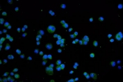 Immunofluorescent staining of FFPE human T-47D cells with TRPV1 antibody (green) and DAPI nuclear stain (blue). HIER: steam section in pH6 citrate buffer for 20 min.