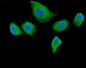Immunofluorescent staining of FFPE human HeLa cells with DAB2 antibody (green) and DAPI nuclear stain (blue). HIER: steam section in pH6 citrate buffer for 20 min.