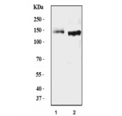 Western blot testing of human 1) A431 and 2) HaCaT cell lysate with DSG3 antibody. Predicted molecular weight: 107 kDa but may be observed at higher molecular weights due to glycosylation.
