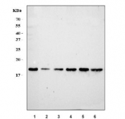 Western blot testing of human 1) HeLa, 2) MOLT-4, 3) Jukat, 4) MCF7, 5) Caco-2 and 6) U-937 cell lysate with Eukaryotic translation initiation factor 5A-1 antibody. Predicted molecular weight: ~20 kDa.