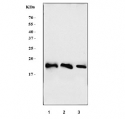 Western blot testing of 1) rat pancreas, 2) mouse pancreas and 3) mouse C2C12 cell lysate with Eukaryotic translation initiation factor 5A-1 antibody. Predicted molecular weight: ~20 kDa.