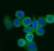 Immunofluorescent staining of FFPE human SiHa cells with Eukaryotic translation initiation factor 5A-1 antibody (green) and DAPI nuclear stain (blue). HIER: steam section in pH6 citrate buffer for 20 min.
