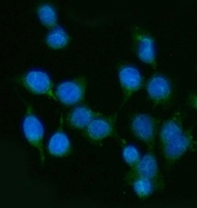 Immunofluorescent staining of FFPE human Caco-2 cells with Uridylate-specific endoribonuclease antibody (green) and DAPI nuclear stain (blue). HIER: steam section in pH6 citrate buffer for 20 min.