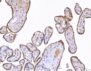 IHC staining of FFPE human placental tissue with Uridylate-specific endoribonuclease antibody. HIER: boil tissue sections in pH8 EDTA for 20 min and allow to cool before testing.