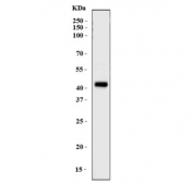 Western blot testing of human placental tissue with Uridylate-specific endoribonuclease antibody. Predicted molecular weight ~47 kDa.