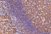 IHC staining of FFPE human chronic tonsillitis tissue with ENO1 antibody. HIER: boil tissue sections in pH8 EDTA for 20 min and allow to cool before testing.