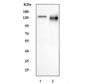 Western blot testing of human 1) HepG2 and 2) HCCP cell lysate with PC-1 antibody. Predicted molecular weight ~105 kDa but commonly observed at up to ~140 kDa.