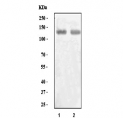 Western blot testing of human 1) MOLT4 and 2) placental tissue lysate with Eph receptor A3 antibody. Predicted molecular weight: 110/61 kDa (isoforms 1/2).