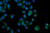 Immunofluorescent staining of FFPE human PC-3 cells with Eph receptor A3 antibody (green) and DAPI nuclear stain (blue). HIER: steam section in pH6 citrate buffer for 20 min.