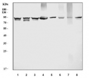 Western blot testing of 1) human HeLa, 2) human HepG2, 3) human Caco-2, 4) human HL-60, 5) rat liver, 6) rat RH35, 7) mouse liver and 8) mouse HEPA1-6 cell lysate with Prothrombin antibody. Predicted molecular weight ~70 kDa but may be observed at higher molecular weights due to glycosylation.