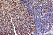 IHC staining of FFPE human tonsil tissue with Flap endonuclease 1 antibody. HIER: boil tissue sections in pH8 EDTA for 20 min and allow to cool before testing.