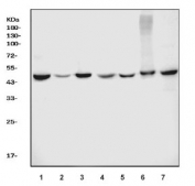 Western blot testing of 1) human HeLa, 2) human Jurkat, 3) human MOLT4, 4) rat thymus, 5) rat PC-12, 6) mouse thymus and 7) mouse RAW264.7 cell lysate with FEN-1 antibody. Expected molecular weight ~45 kDa.
