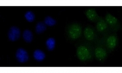 Immunofluorescent staining of FFPE human MCF7 cells with FEN1 antibody (green) and DAPI nuclear stain (blue). HIER: steam section in pH6 citrate buffer for 20 min.