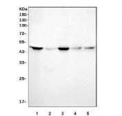 Western blot testing of 1) human HeLa, 2) human Jurkat, 3) human MOLT4, 4) mouse thymus and 5) mouse RAW264.7 cell lysate with FEN-1 antibody. Expected molecular weight ~45 kDa.