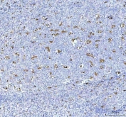 IHC staining of FFPE human tonsil tissue with CD68 antibody. HIER: boil tissue sections in pH8 EDTA for 20 min and allow to cool before testing.