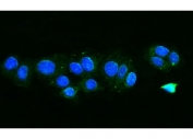Immunofluorescent staining of FFPE human MCF7 cells with FIS1 antibody (green) and DAPI nuclear stain (blue). HIER: steam section in pH6 citrate buffer for 20 min.