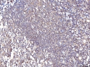 IHC staining of FFPE human chronic tonsillitis tissue with FIS1 antibody. HIER: boil tissue sections in pH8 EDTA for 20 min and allow to cool before testing.