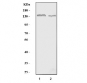 Western blot testing of 1) rat brain and 2) mouse brain tissue lysate with HCN4 antibody. Predicted molecular weight ~129 kDa but can be observed at up to ~160 kDa.