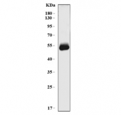 Western blot testing of human HCCP cell lysate with Homogentisate 1,2-dioxygenase antibody. Predicted molecular weight ~50 kDa.