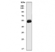 Western blot testing of human HCCP cell lysate with Homogentisate 1,2-dioxygenase antibody. Predicted molecular weight ~50 kDa.